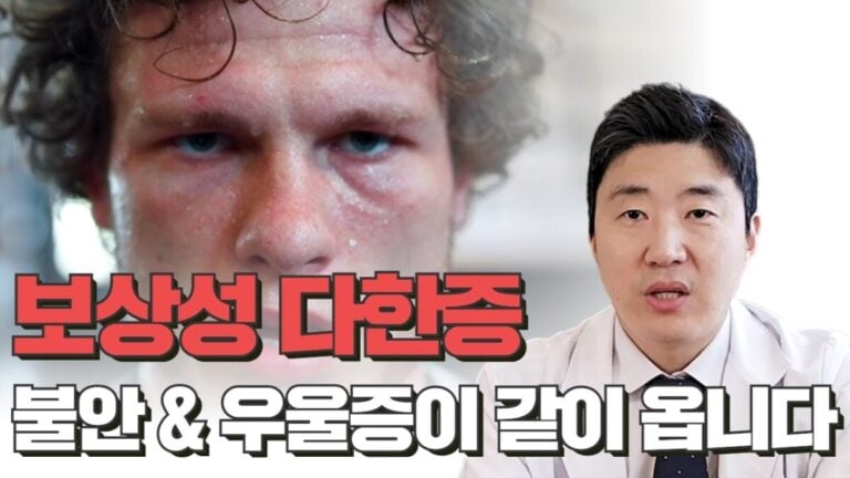 보상성 다한증으로 땀이 늘어나고 불안과 우울 증상이 함께 나타나는 자율신경 문제를 설명하는 이미지