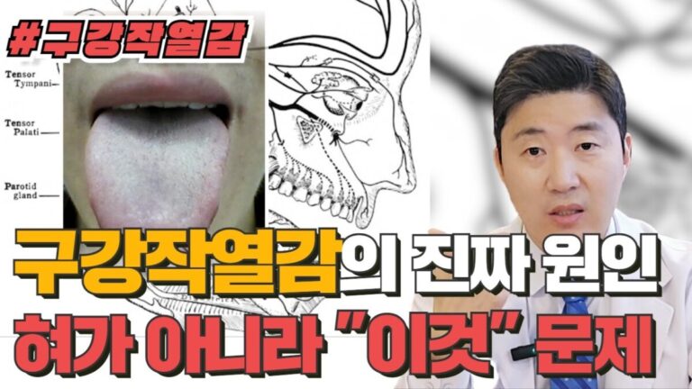 구강작열감 증상이 혀 자체 문제가 아닌 뇌와 신경 조절 이상에서 발생할 수 있음을 설명하는 이미지