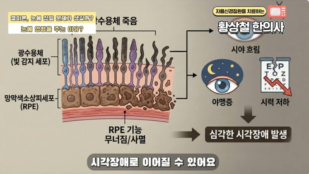Image explaining the connection between autonomic nerves and bladder pain