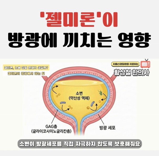 Schematic diagram of bladder endothelial injury in interstitial cystitis