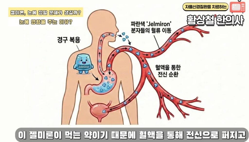 Conceptual diagram of intravesical drug infusion therapy