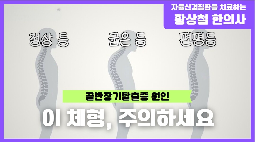 방광류 유발 체형