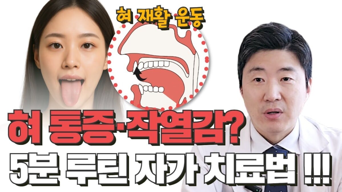 구강작열감
