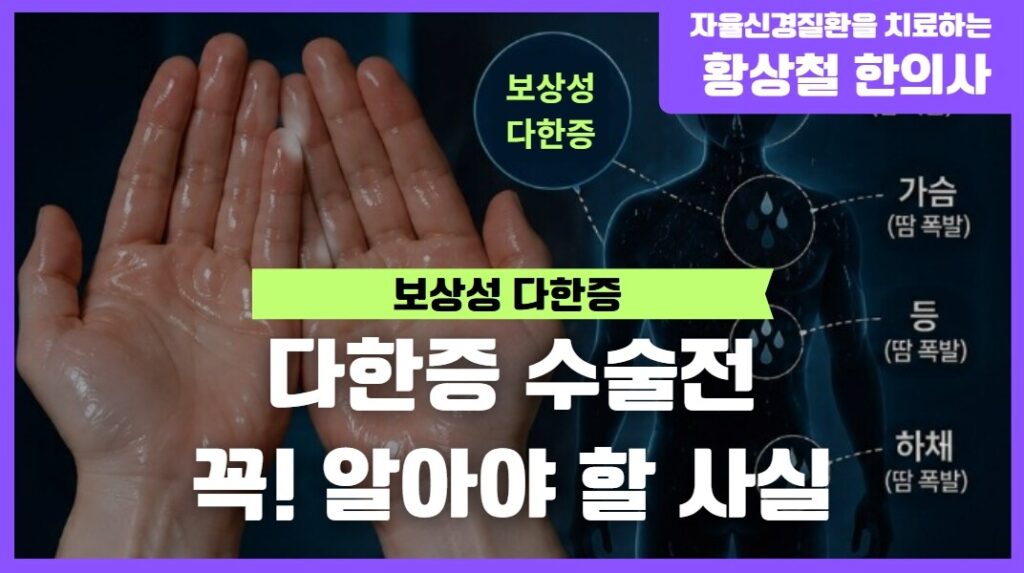 다한증 수술 전 꼭 알아야 할 사실